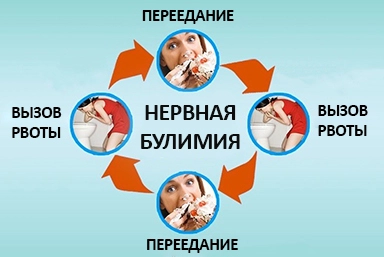 Лечение булимии в Ярославле